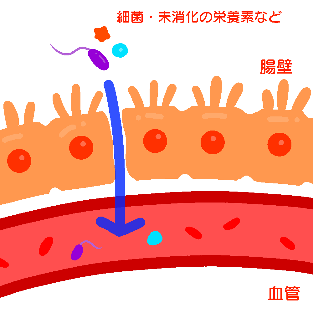 リーキーガットのイメージ