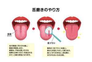 舌苔みがきの方法